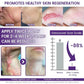 TiMilk - ReGen Scar Stem Cell Repair Gel (Imported)